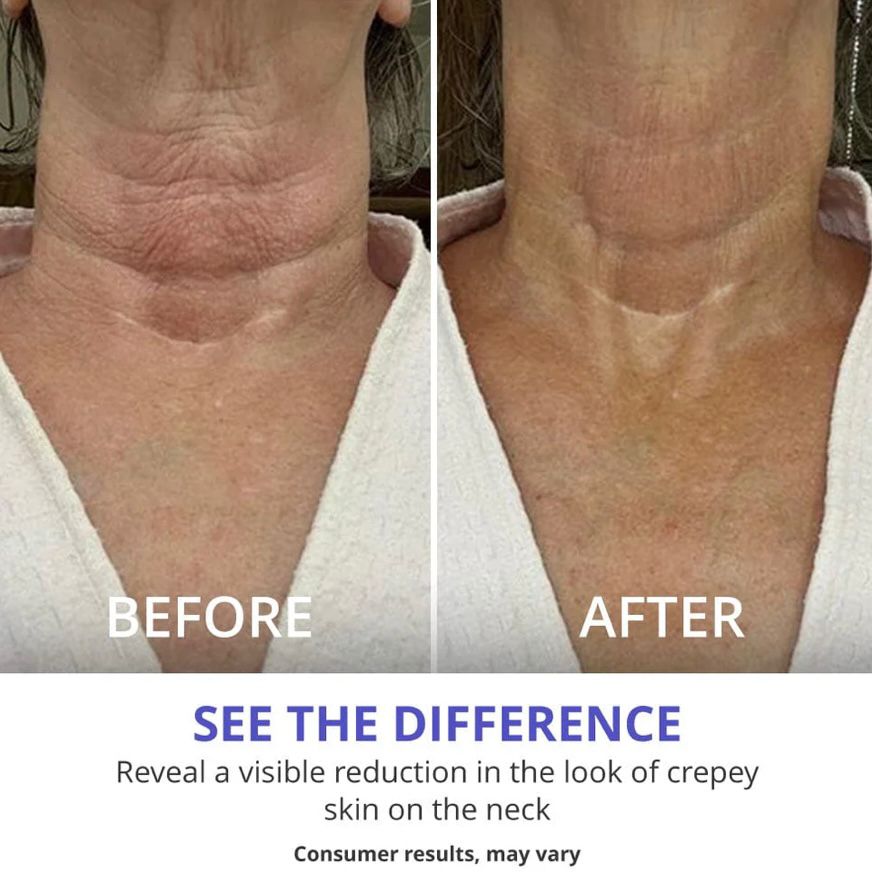 TuxodoCARE - Tighten & Lift Neck Cream