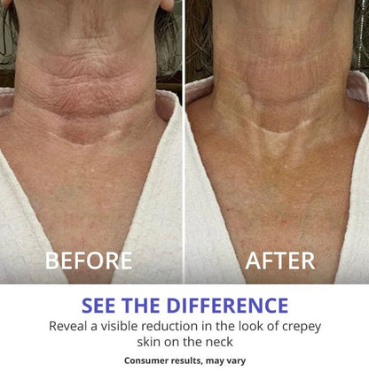 TuxodoCARE - Tighten & Lift Neck Cream